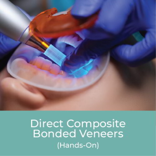 Direct Composite Bonded Veneers - A Digital Guided Approach