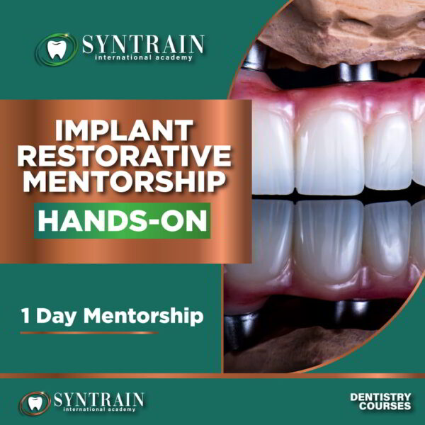 Implant Restorative Mentorship