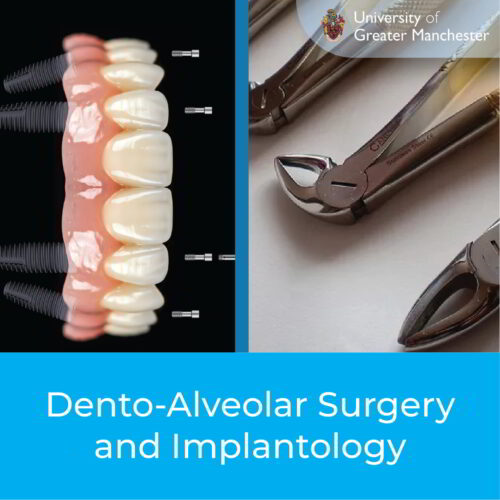 Dento-Alveolar Surgery and Implantology