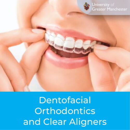 Dentofacial Orthodontics and Clear Aligners