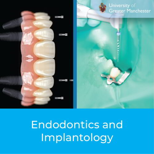 Endodontics and Implantology