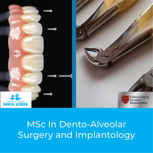 Dento-Alveolar Surgery and Implantology