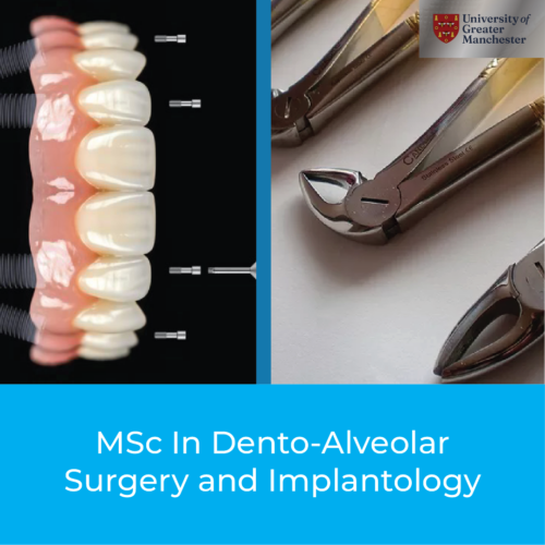 Dento-Alveolar Surgery and Implantology