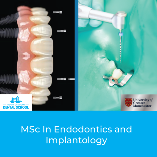 Endodontics and Implantology