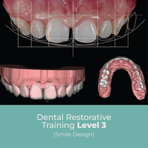 Dental Restorative Training Level 3
