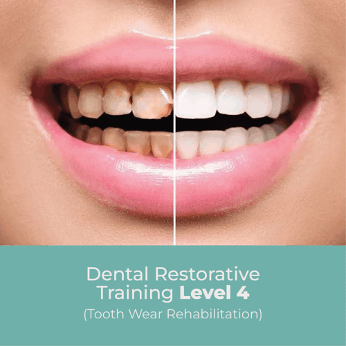 Dental Restorative Training Level 4
