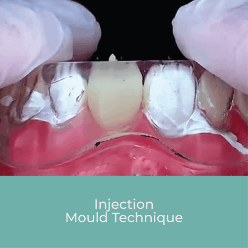 Injection Mould Technique
